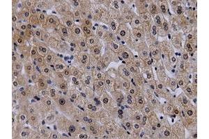 Immunohistochemical staining of paraffin-embedded Human liver tissue using anti-VWA5A mouse monoclonal antibody. (VWA5A anticorps)