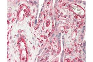 Human Placenta: Formalin-Fixed, Paraffin-Embedded (FFPE).