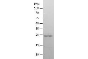 Western Blotting (WB) image for GATA Binding Protein 3 (GATA3) (AA 1-209) protein (His tag) (ABIN7123064)
