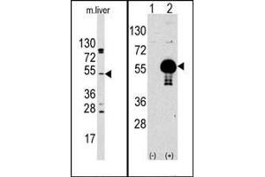 (LEFT)Western blot analysis of anti-AKT2 Antibody (N-term) Pab in mouse liver tissue lysates (35ug/lane). (AKT2 anticorps  (N-Term))