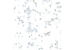Immunocytochemistry (ICC) image for anti-Twist Homolog 1 (Drosophila) (TWIST1) (AA 1-50) antibody (ABIN7453340) (Recombinant TWIST1 anticorps  (AA 1-50))