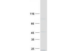 Validation with Western Blot