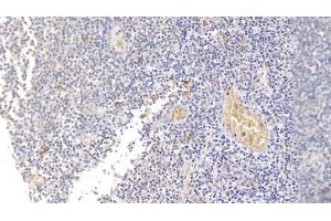 Detection of SDC1 in Human Tonsil Tissue using Monoclonal Antibody to Syndecan 1 (SDC1) (Syndecan 1 anticorps  (AA 23-253))