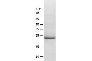 Western Blotting (WB) image for HtrA Serine Peptidase 4 (HTRA4) (AA 159-376) protein (His-IF2DI Tag) (ABIN7123368)
