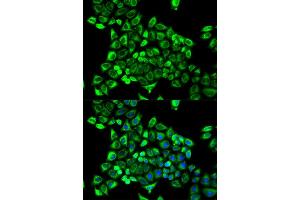 Immunofluorescence analysis of MCF-7 cell using CDA antibody. (CDA anticorps  (AA 1-146))