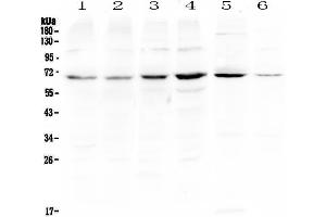 Western blot analysis of PIAS3 using anti-PIAS3 antibody . (PIAS3 anticorps)