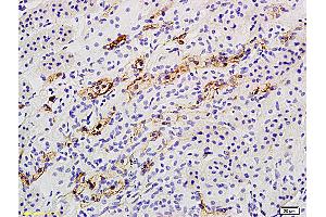 Formalin-fixed and paraffin embedded rat kidney labeled with Anti Catalase Polyclonal Antibody, Unconjugated (ABIN872991) followed by conjugation to the secondary antibody and DAB staining (Catalase anticorps  (AA 251-350))