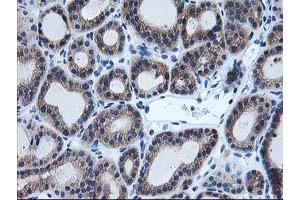 Image no. 3 for anti-Aryl Hydrocarbon Receptor Interacting Protein-Like 1 (AIPL1) antibody (ABIN1496508) (AIPL1 anticorps)