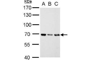 WB Image RecQ1 antibody [N1N2], N-term detects RecQ1 protein by Western blot analysis.