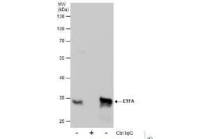 IP Image Immunoprecipitation of ETFA protein from HepG2 whole cell extracts using 5 μg of ETFA antibody, Western blot analysis was performed using ETFA antibody, EasyBlot anti-Rabbit IgG  was used as a secondary reagent. (ETFA anticorps  (Center))