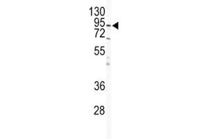 Western blot analysis of IKK beta antibody and HeLa lysate.