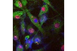 Tau-stable SY5Y cell image stained for endogenous LRRK (green) by Abgent L955a (affinity purified), phosphorylated tau (red, monoclonal AT8) and nuclear staining by DI.
