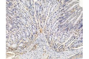ABIN6265565 and ABIN6278949 at 1/100 staining mouse stomach tissue by IHC-P. (TIAF1 anticorps  (C-Term))