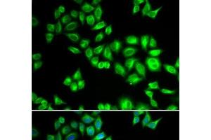 Immunofluorescence analysis of HeLa cells using CUL1 Polyclonal Antibody (Cullin 1 anticorps)