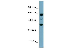 SEC22C antibody used at 1 ug/ml to detect target protein. (SEC22C anticorps)
