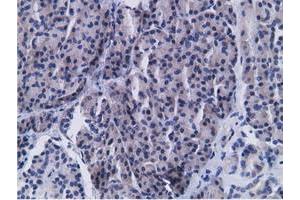 Immunohistochemical staining of paraffin-embedded Carcinoma of Human kidney tissue using anti-CD80 mouse monoclonal antibody. (CD80 anticorps)