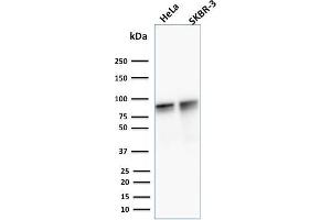 Western Blot Analysis of human HeLa and SK-BR3 cell lysate using Catenin, gamma Mouse Monoclonal Antibody (11E4).