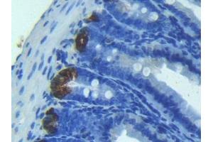 anti-Angiogenin (ANG) antibody