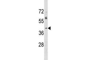 ABO antibody western blot analysis in MDA-MB231 lysate