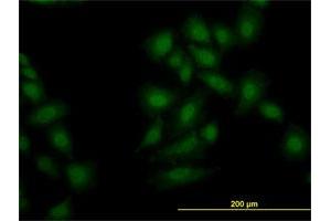 Immunofluorescence of monoclonal antibody to OXSR1 on HeLa cell. (OXSR1 anticorps  (AA 1-527))