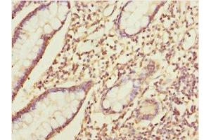 Immunohistochemistry of paraffin-embedded human small intestine tissue using ABIN7156265 at dilution of 1:100 (IKbIP anticorps  (AA 121-350))