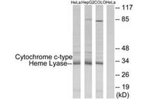 Western blot analysis of extracts from HeLa/HepG2/COLO cells, using Cytochrome c-type Heme Lyase Antibody. (HCCS anticorps  (AA 81-130))