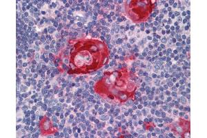 Anti-ZFP36 antibody IHC of human thymus. (ZFP36 anticorps  (AA 41-90))