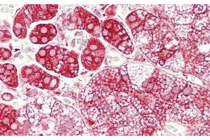 Detection of GLa in Human Adrenal Gland Tissue using Polyclonal Antibody to Galactosidase Alpha (GLa)
