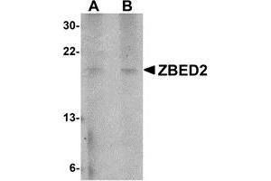Western Blotting (WB) image for anti-Zinc Finger, BED-Type Containing 2 (ZBED2) (N-Term) antibody (ABIN1031669) (ZBED2 anticorps  (N-Term))