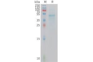Mouse IL23A Protein, hFc Tag on SDS-PAGE under reducing condition.