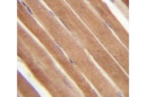 EphB2 antibody analysis in formalin fixed and paraffin embedded human skeletal muscle