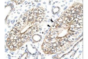 Image no. 1 for anti-MYST/Esa1-Associated Factor 6 (MEAF6) (N-Term) antibody (ABIN6736265)