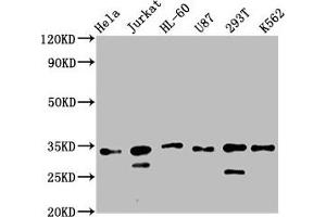 Western Blot Positive WB detected in: Hela whole cell lysate, Jurkat whole cell lysate, HL60 whole cell lysate, U87 whole cell lysate, 293T whole cell lysate, K562 whole cell lysate All lanes: TSNAX antibody at 2. (TSNAX anticorps  (AA 1-87))