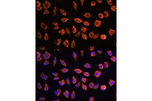 Immunofluorescence analysis of L929 cells using NOTCH3 Rabbit pAb (ABIN1681077, ABIN3015390, ABIN3015391 and ABIN6214032) at dilution of 1:100. (NOTCH3 anticorps  (AA 751-850))