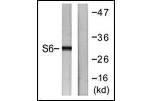 Western blot analysis of extracts from HeLa cells, treated with TNF-a 20ng/ml 2', using. (RPS6 anticorps  (C-Term))