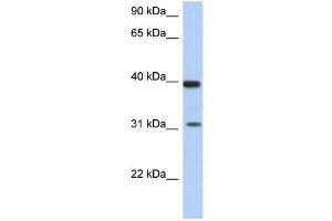 WB Suggested Anti-RPSA Antibody Titration: 0. (RPSA/Laminin Receptor anticorps  (Middle Region))