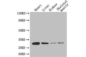 Western Blot Positive WB detected in: Mouse heart tissue, Mouse liver tissue, Mouse kidney tissue, Mouse skeletal muscle tissue All lanes: ADIPOQ antibody at 4 μg/mL Secondary Goat polyclonal to rabbit IgG at 1/50000 dilution Predicted band size: 27 kDa Observed band size: 27 kDa (ADIPOQ anticorps  (AA 19-244))