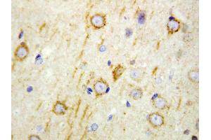 Anti-GAD65 antibody, IHC(P): Rat Brain Tissue (GAD65 anticorps  (N-Term))