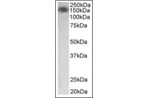 Staining of Human Colon lysate (35µg protein in RIPA buffer) using MYLK antibody at0. (MYLK anticorps  (Internal Region))