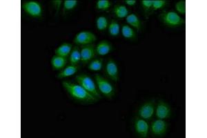 Immunofluorescent analysis of A549 cells using ABIN7161691 at dilution of 1:100 and Alexa Fluor 488-congugated AffiniPure Goat Anti-Rabbit IgG(H+L)