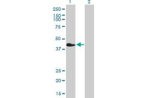 Western Blot analysis of CHIA expression in transfected 293T cell line by CHIA MaxPab polyclonal antibody.