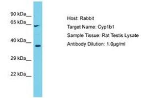 Image no. 1 for anti-Cytochrome P450, Family 1, Subfamily B, Polypeptide 1 (CYP1B1) (AA 294-343) antibody (ABIN6750328) (CYP1B1 anticorps  (AA 294-343))
