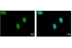 ICC/IF Image DNA ligase III antibody detects LIG3 protein at nucleus by immunofluorescent analysis. (LIG3 anticorps)