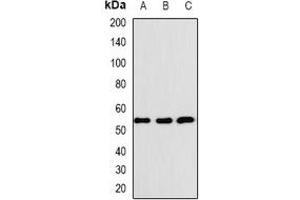 Western blot analysis of BAF57 expression in K562 (A), SHSY5Y (B), SKOV3 (C) whole cell lysates. (SMARCE1 anticorps)