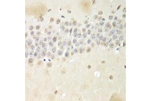 Immunohistochemistry of paraffin-embedded mouse brain using Nono Antibody (ABIN5973035) at dilution of 1/100 (40x lens). (NONO anticorps)