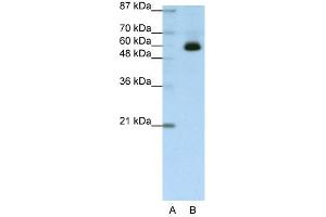 WB Suggested Anti-ZNF307 Antibody Titration:  1. (ZKSCAN4 anticorps  (C-Term))