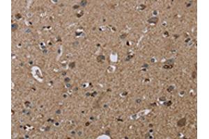 The image on the left is immunohistochemistry of paraffin-embedded Human brain tissue using ABIN7192919(TRPM1 Antibody) at dilution 1/20, on the right is treated with synthetic peptide. (TRPM1 anticorps)