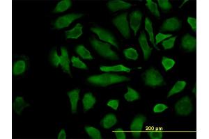 Immunofluorescence of monoclonal antibody to CFLAR on HeLa cell.