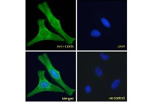 ABIN6391356 Immunofluorescence analysis of paraformaldehyde fixed HeLa cells, permeabilized with 0. (Cadherin 5 anticorps  (Internal Region))