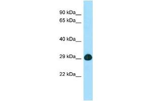 WB Suggested Anti-SLC25A2 Antibody Titration: 1. (SLC25A2 anticorps  (C-Term))